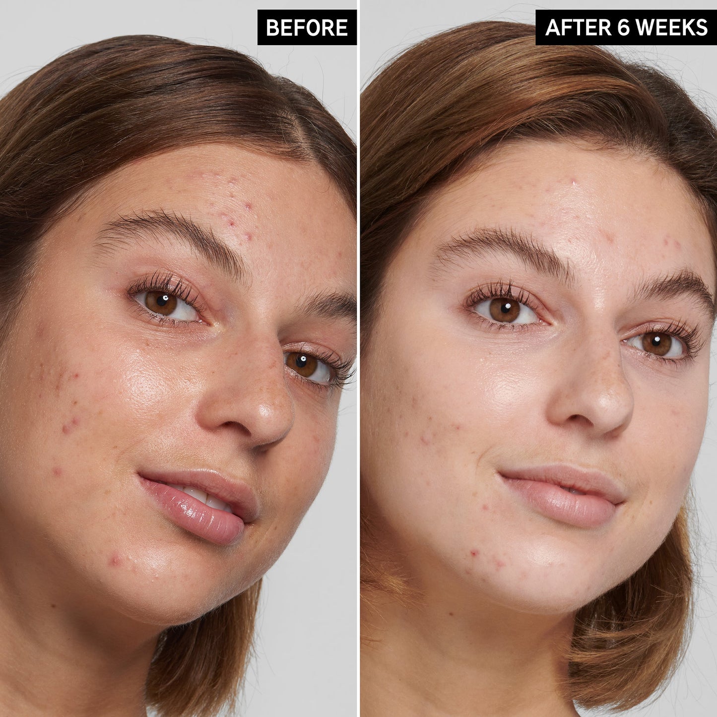 Inkey List Salicylic Acid Cleanser