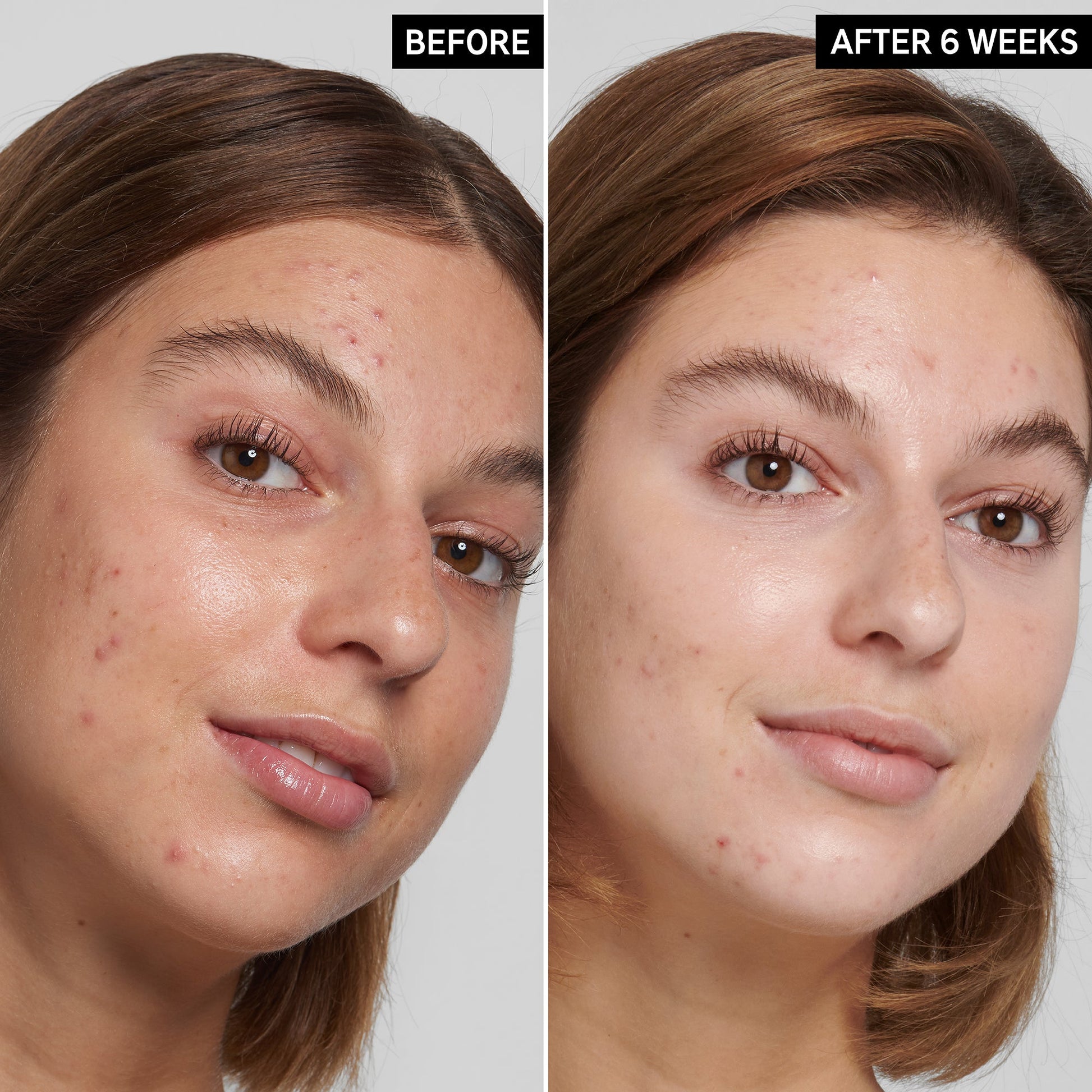 Inkey List Salicylic Acid Cleanser